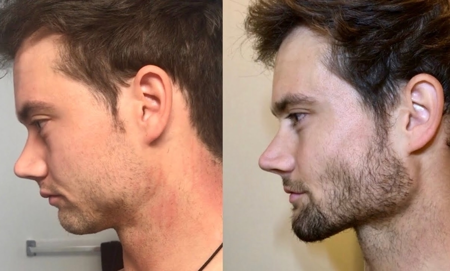 The Benefits Beyond Aesthetics